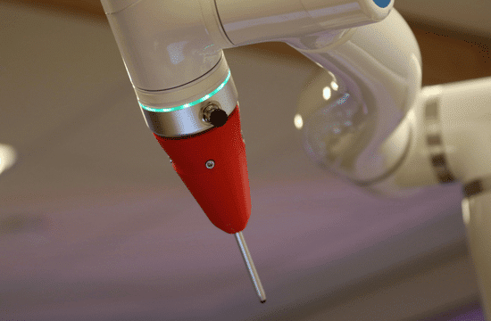 זרוע רובוטית